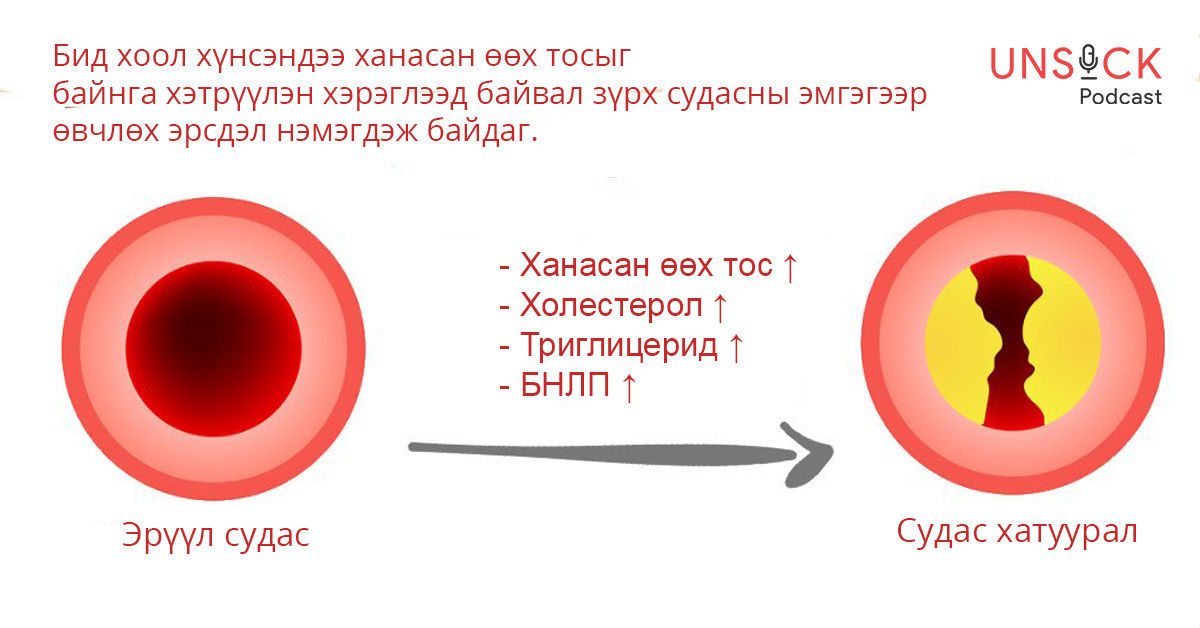 #UNSICK : Цусанд агуулагдах өөх тосны хэмжээгээ мэдсэнээр зүрх судасны ...