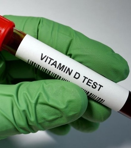 17ea4f vitamin d blood test x220
