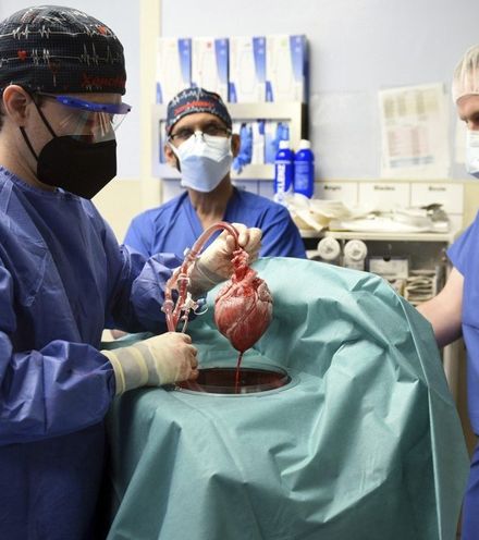 Os4ndd pig heart operation x220